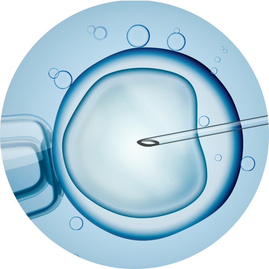 Fertility & IVF